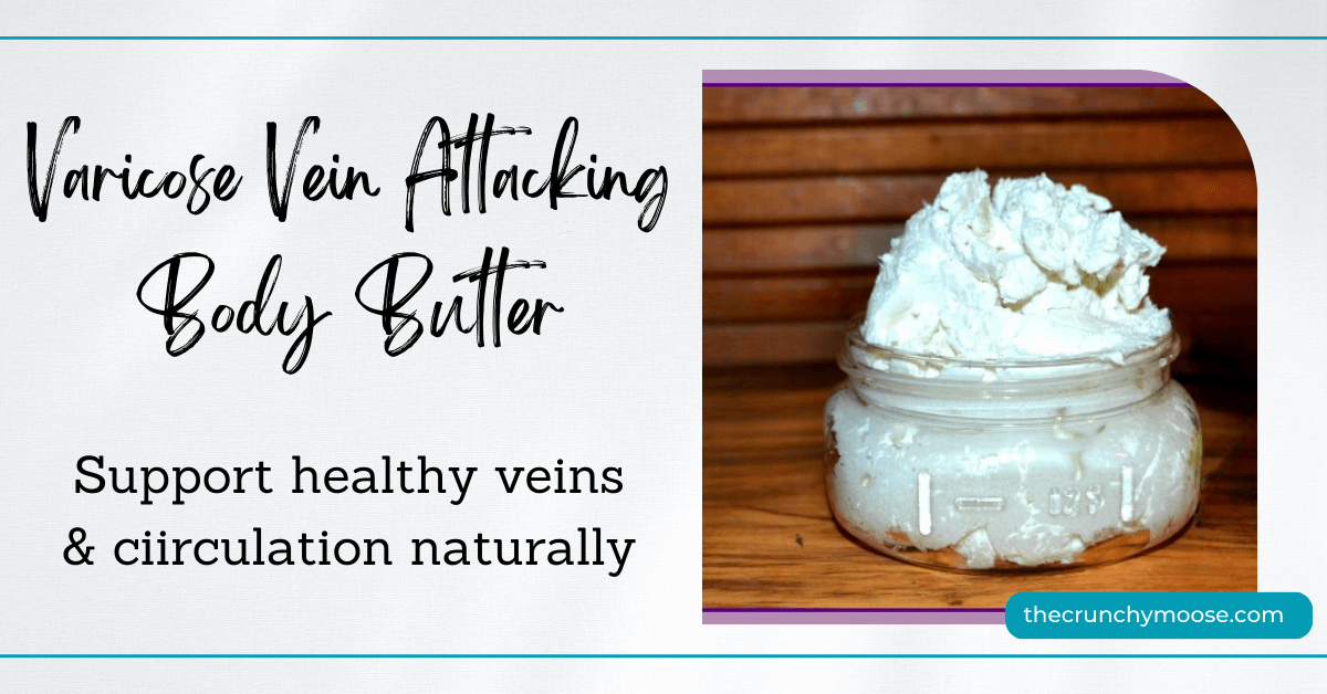 varicose vein attacking body butter with essential oils