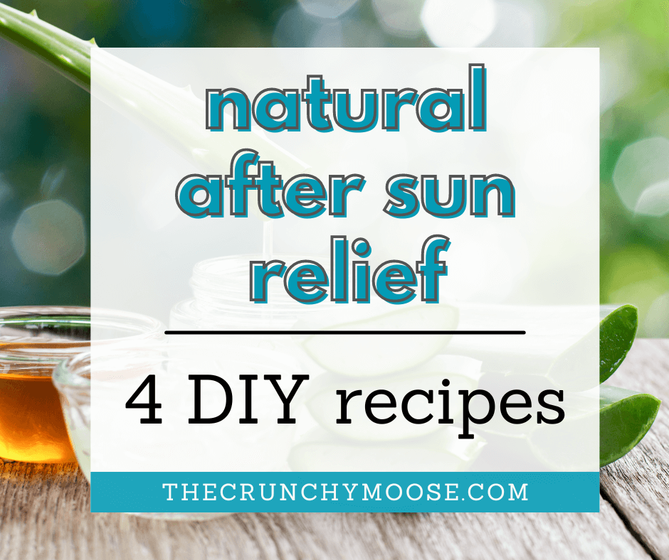 natural sunburn relief