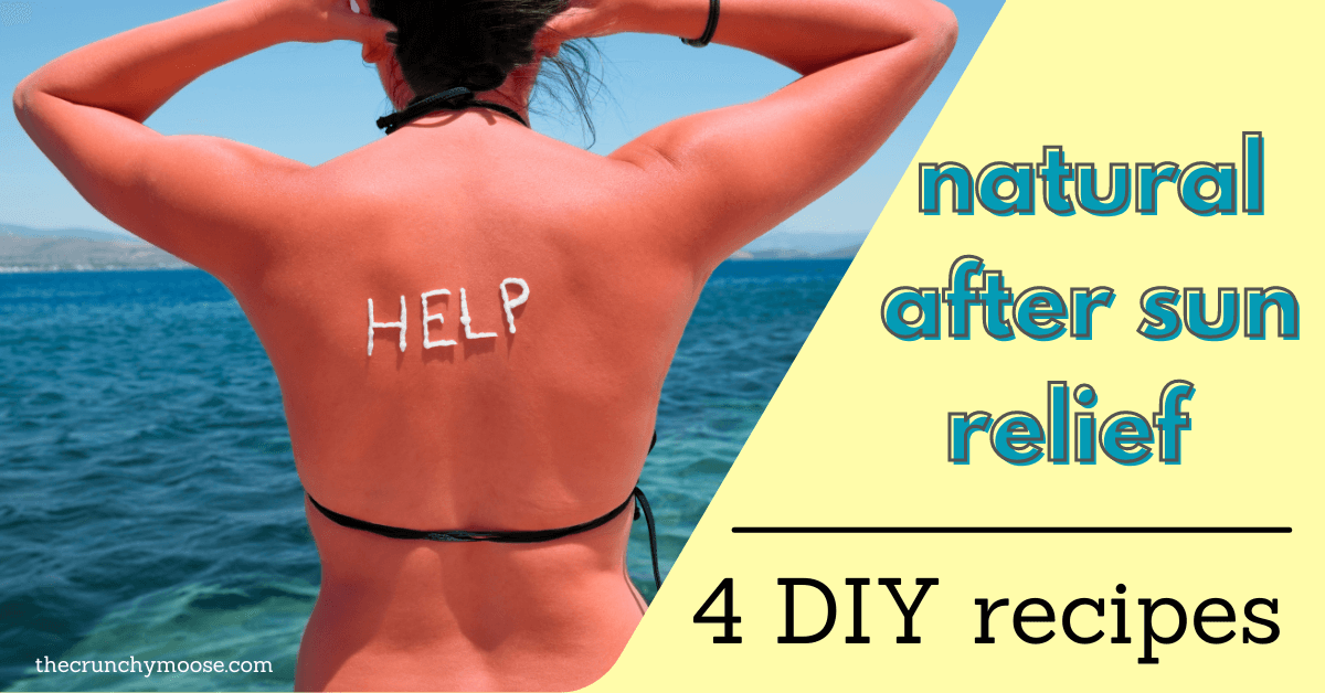 natural sunburn relief with essential oils