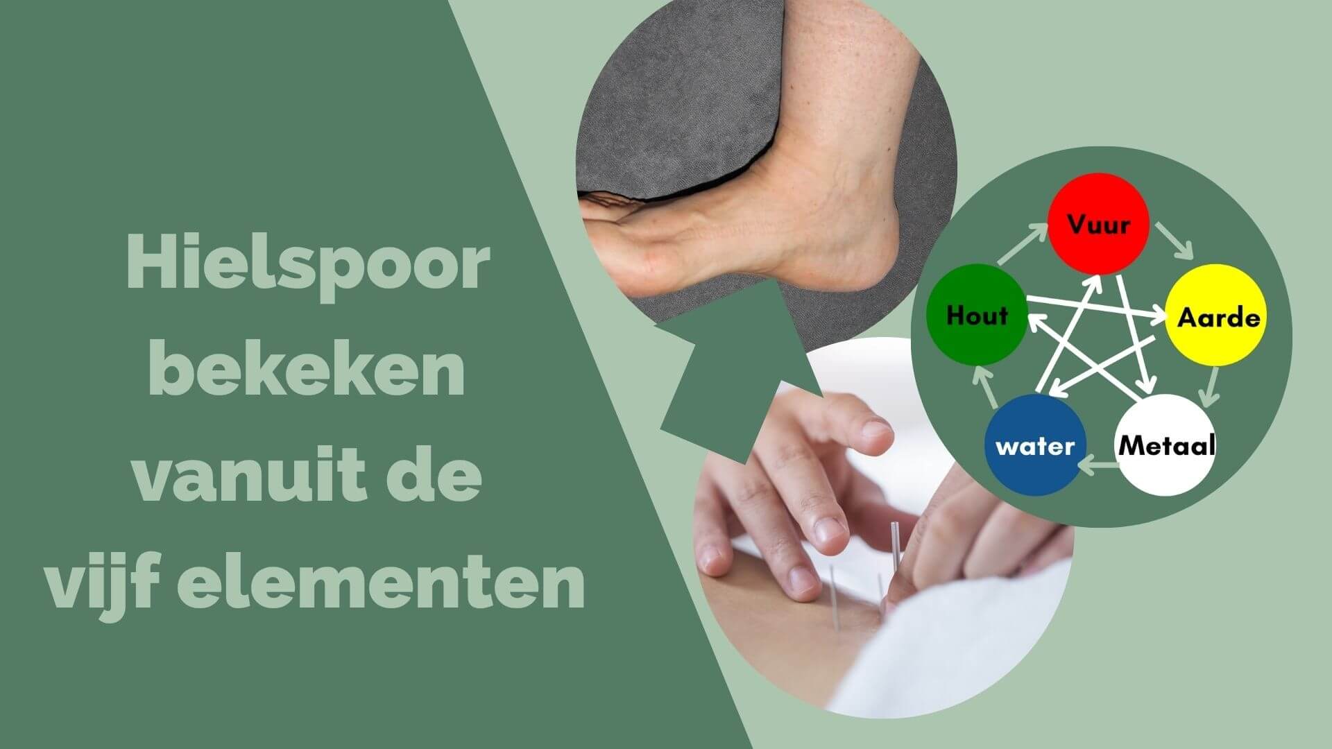  Acupunctuur bij hielspoor