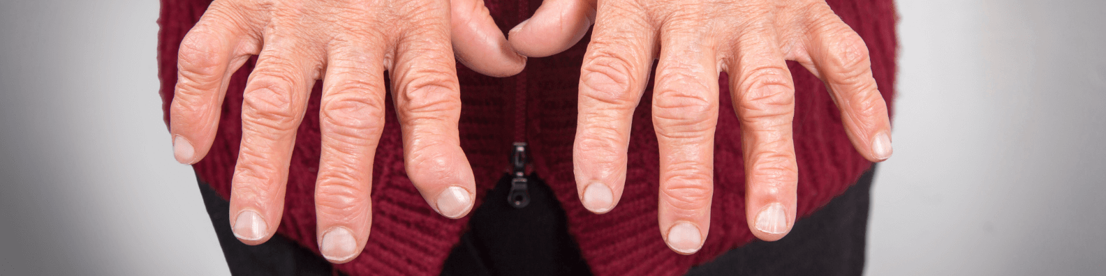 Arthritis due to chronic inflammation